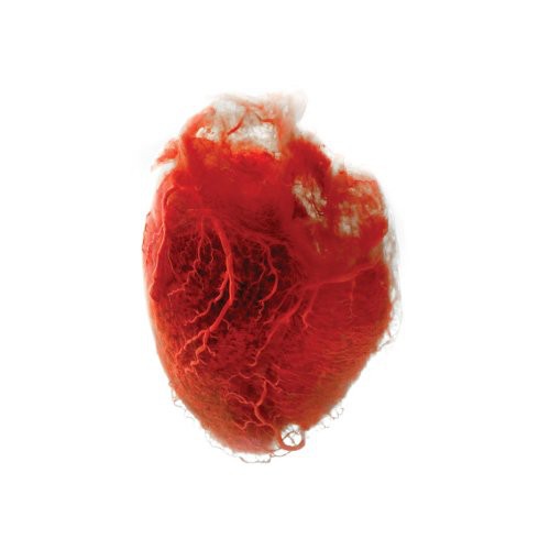 Akron/Family: Love Is Simple - （ VINYL LP ）